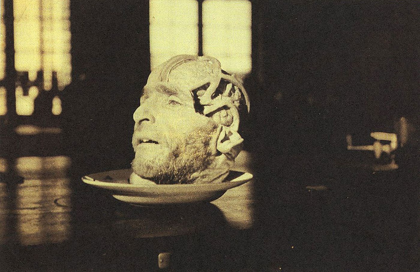 Masterpieces of Medical Photography: Selections from the Burns Archive